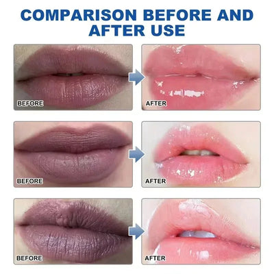 Exfoliating Lip Balm