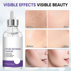 Pore Shrinking Serum
